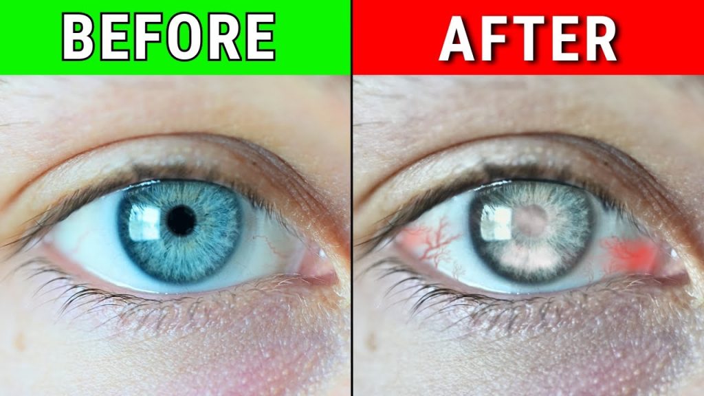 9 Habits (secretly) Ruining Your Eyes