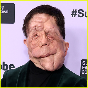 ‘A Different Man’ Star Adam Pearson Speaks Out About Harmful Tropes Actors With Disabilities Face in Hollywood