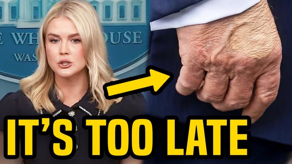Karoline Leavitt CANNOT cover up Trump’s health