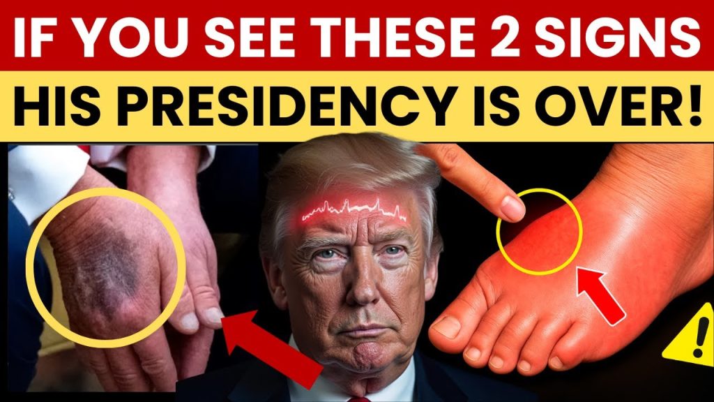 Trump’s Health in Crisis? A Doctor’s SHOCKING Medical Analysis