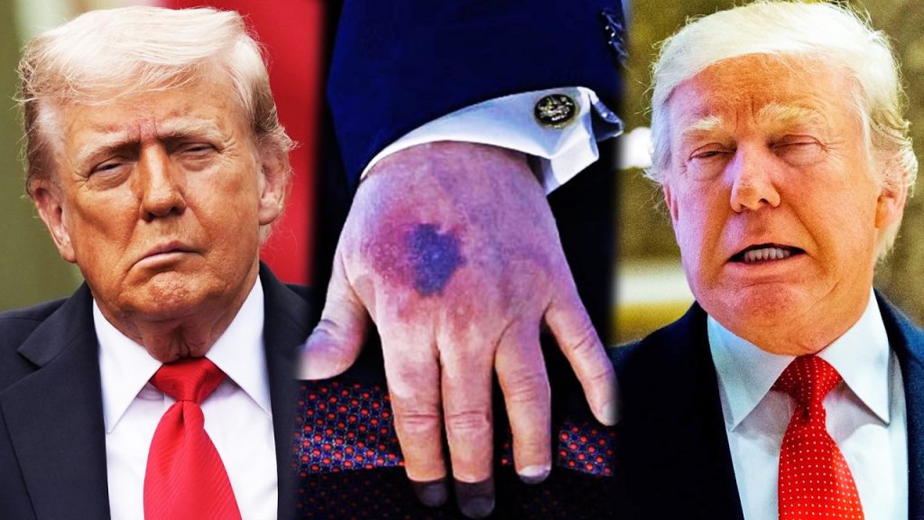 Trump’s health is worse than they’re telling us