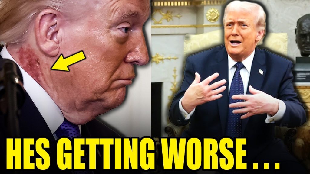 Trump’s Health in FREE FALL After Mental and Physical COLLAPSE