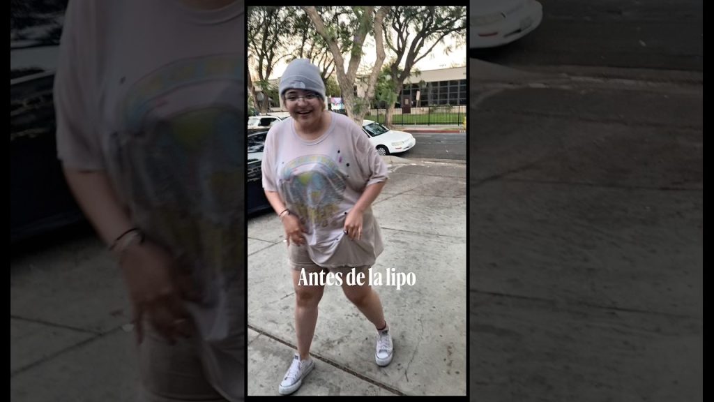 Antes de la lipo #gymmotivation #weightloss #fitness #gymgirl