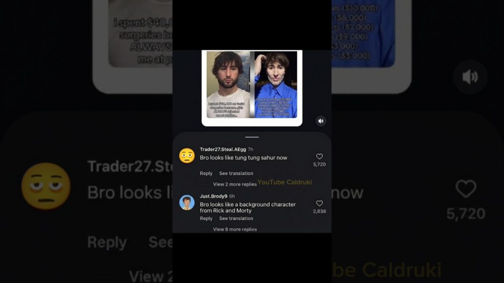 Bro looks like Triple T now 😭🙏 #memes #humor #funny #dankememes #slideshow #shorts